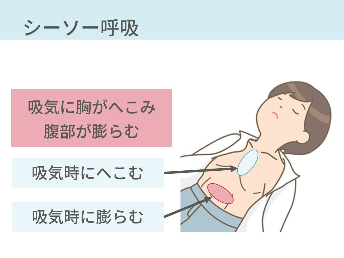 努力呼吸とは？見逃せない危険なサインと緊急度の見極め方を徹底解説