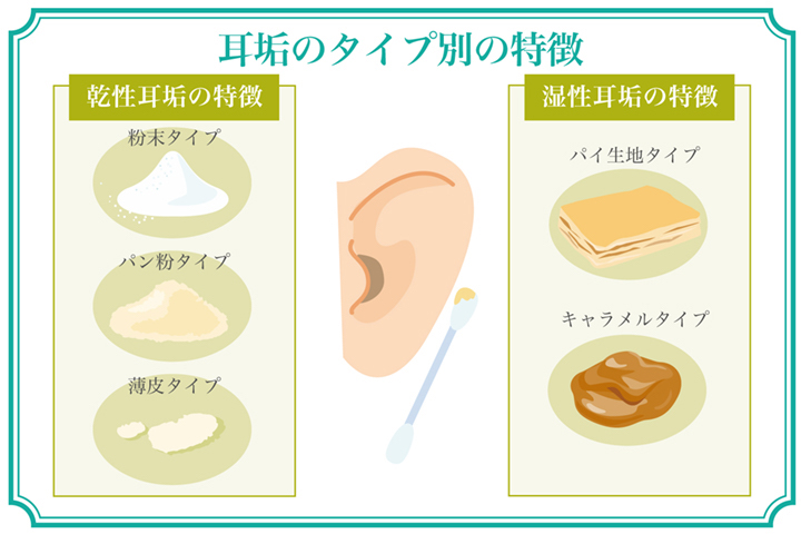 耳垢が湿っている＝ワキガ？遺伝子研究が明かす体質と正しい耳ケア