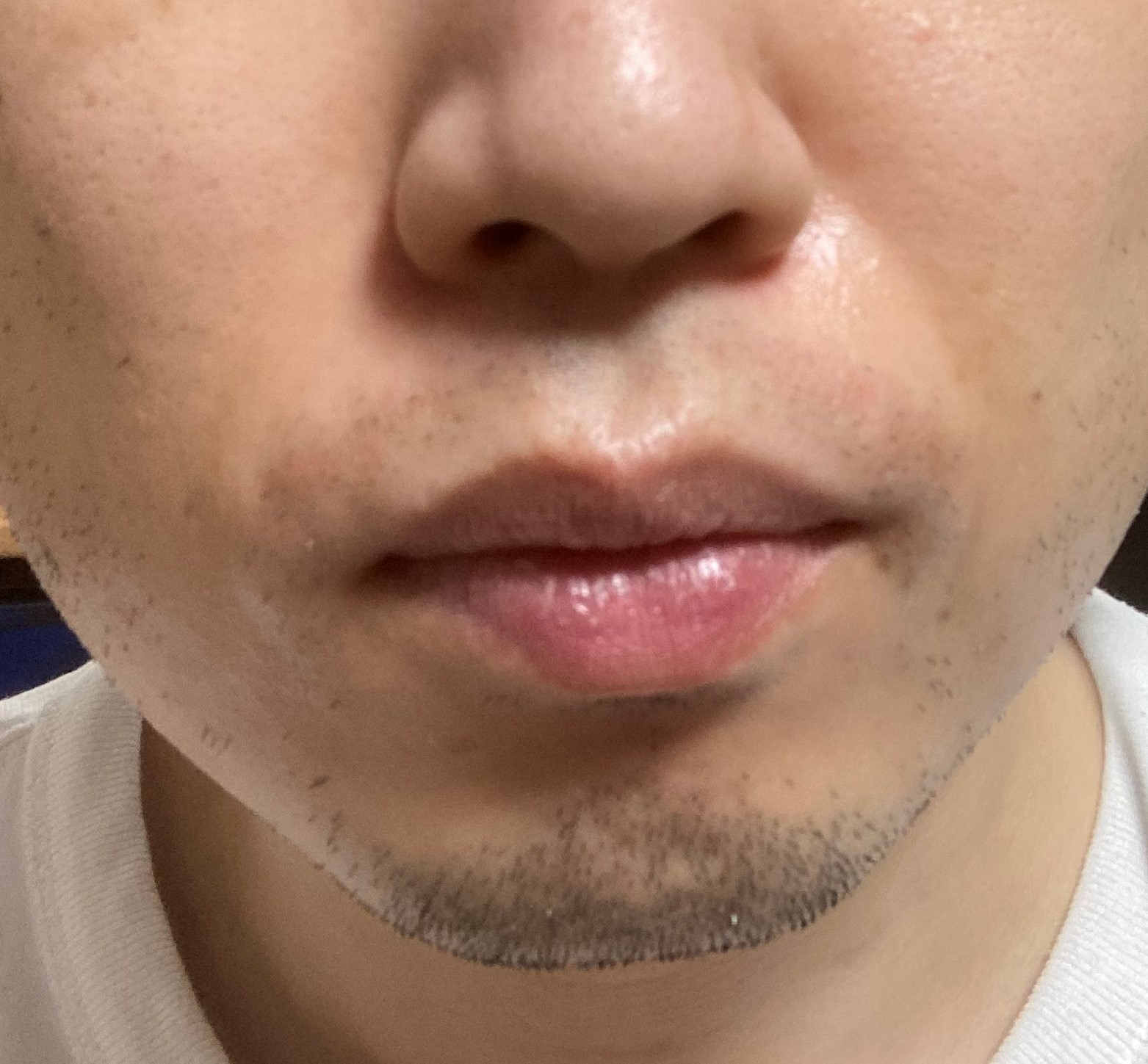 Tbcの500円脱毛は本当に効果あり？口コミの真相と勧誘のからくり