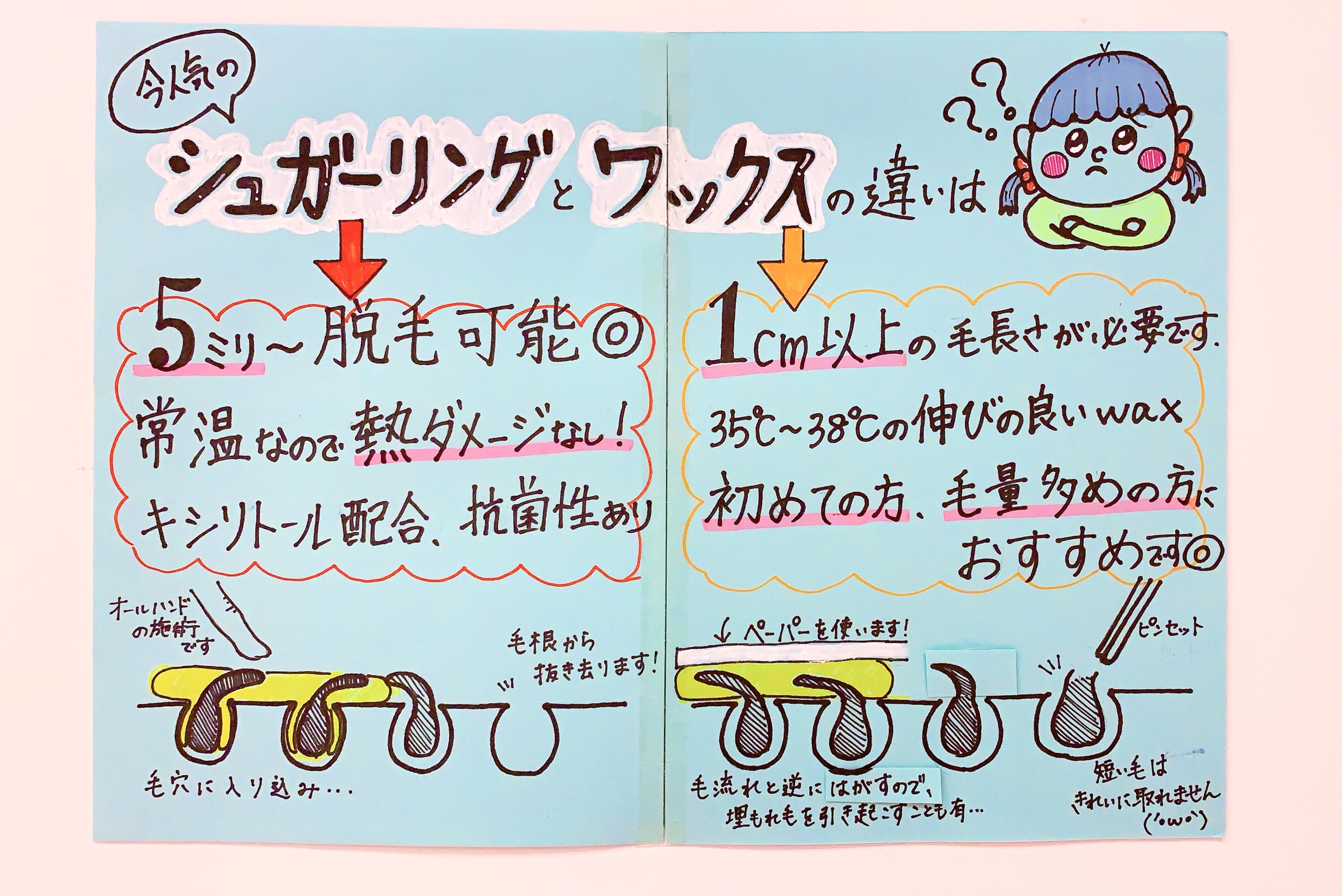 シュガーリング脱毛の真実！ワックスとの違いやVioの痛みを徹底解剖