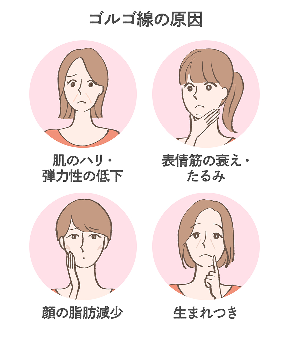 ゴルゴラインとは？ほうれい線との違いと消し方・原因を徹底解明