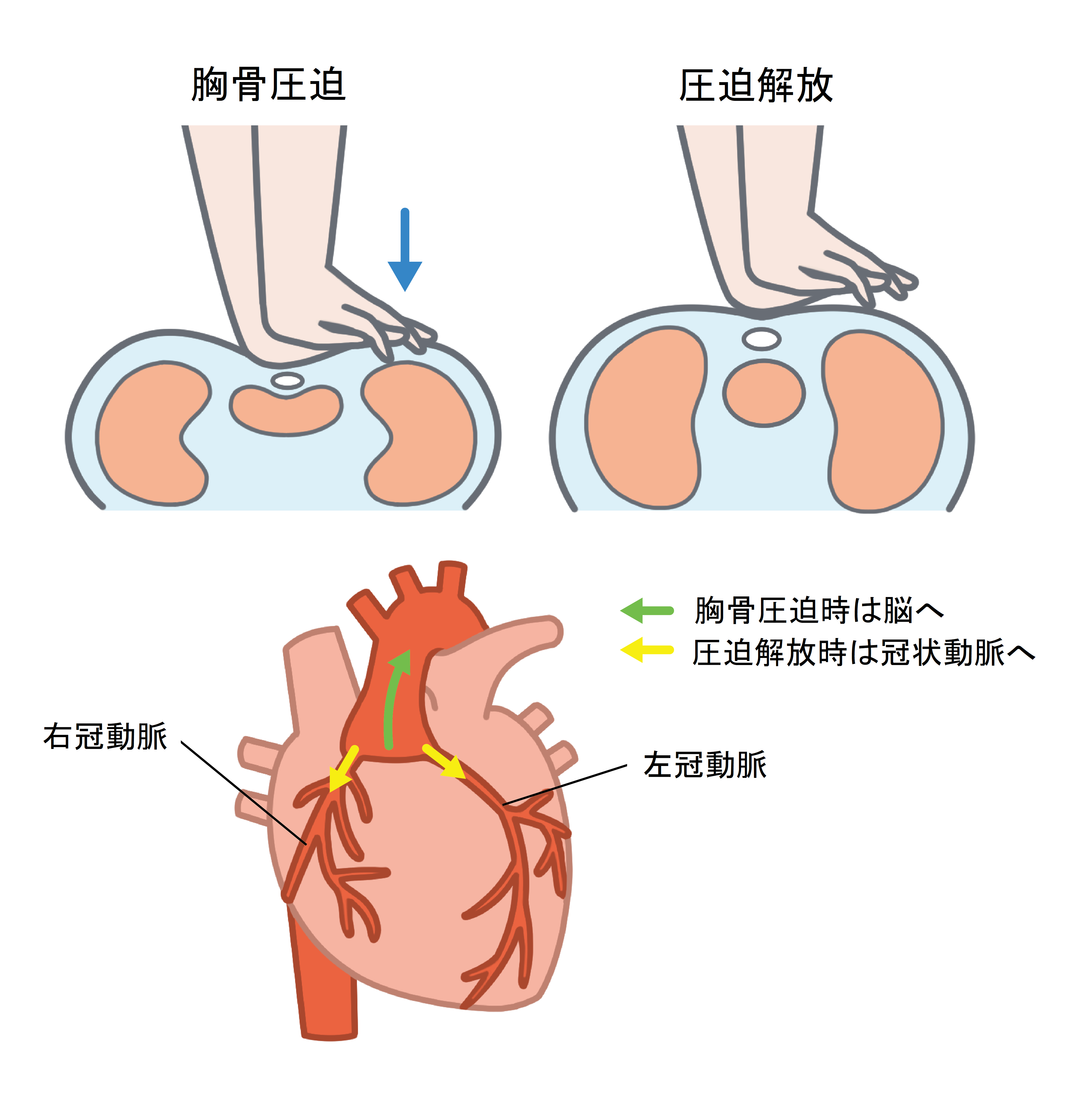 心肺停止とは？死亡との違いやニュースで即死と報じない真相を解説