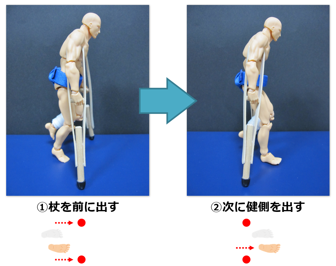 「免荷」とは何か？骨折・術後リハビリの全知識と自己判断の危険性