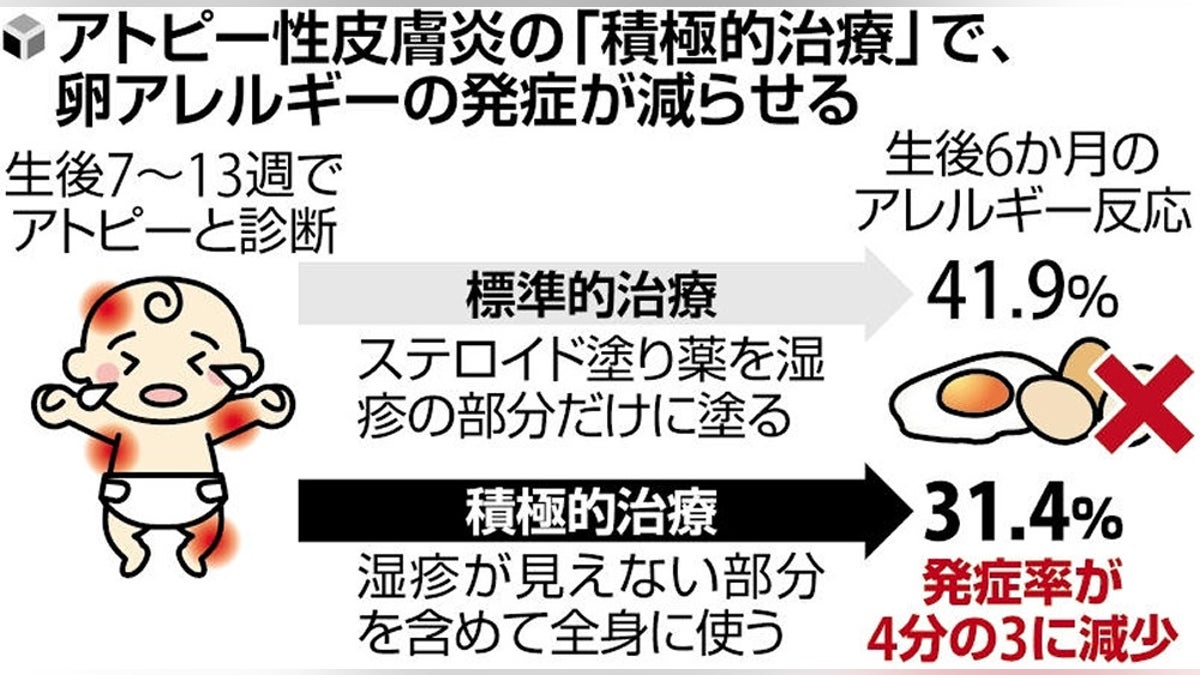 卵でアトピー悪化は本当？自己判断の完全除去に潜むリスクと最新常識