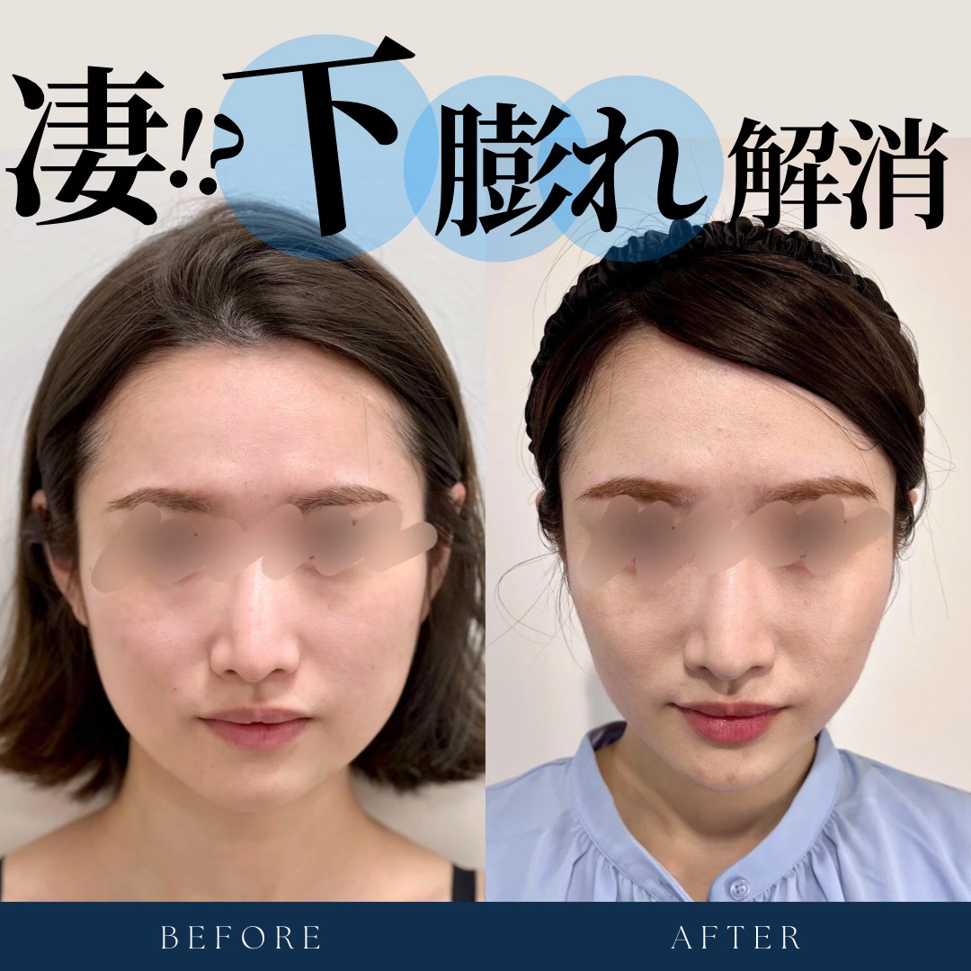 下膨れ芸能人に美女美男が多い理由｜垢抜けと愛され顔の秘密