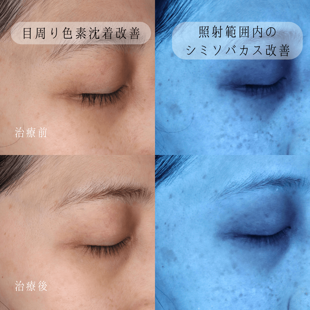 下がり天井と間接照明で生み出す高級感！失敗しない最新トレンド解説