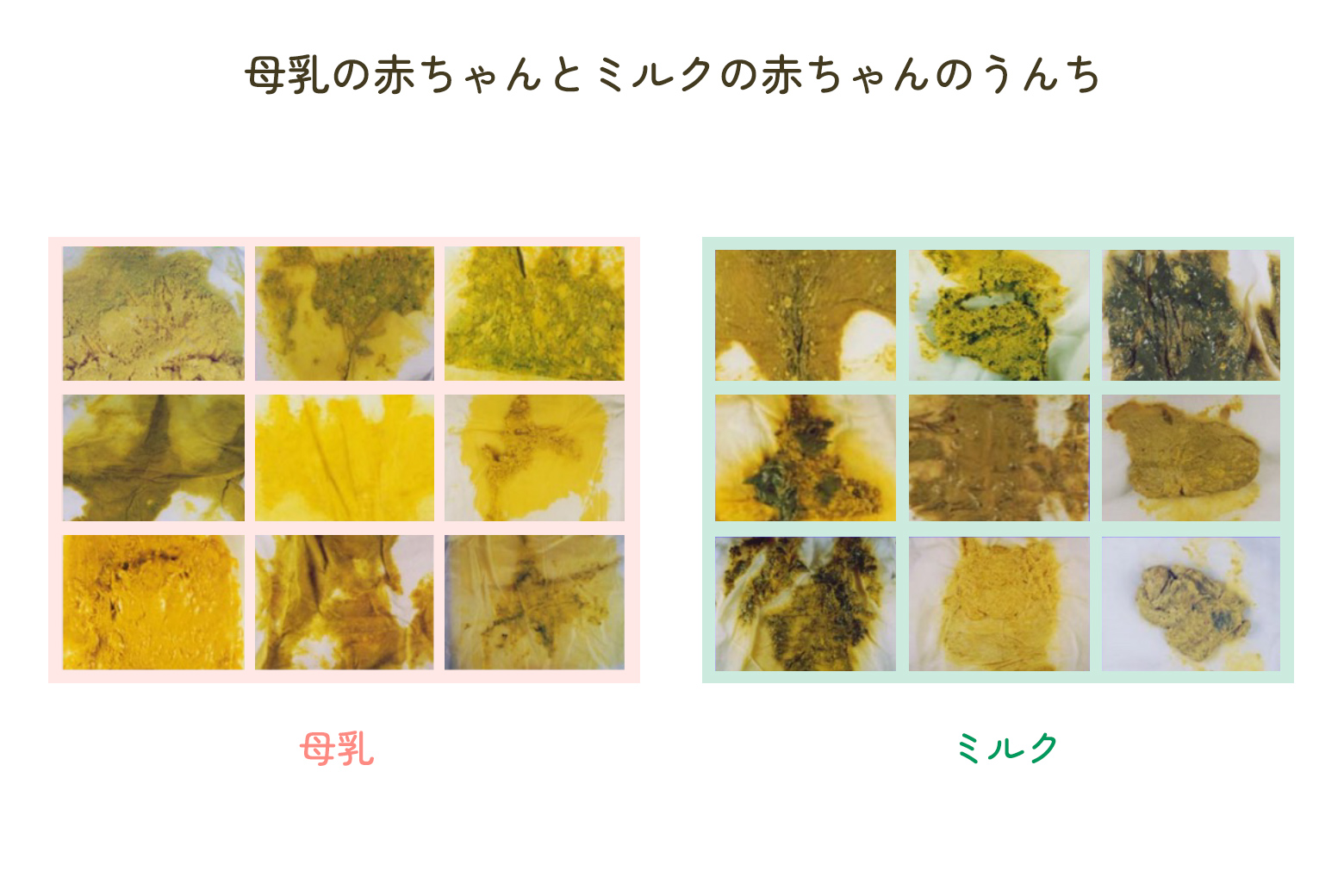 新生児の便に混ざる「つぶつぶ」の正体｜受診目安と危険サイン徹底検証