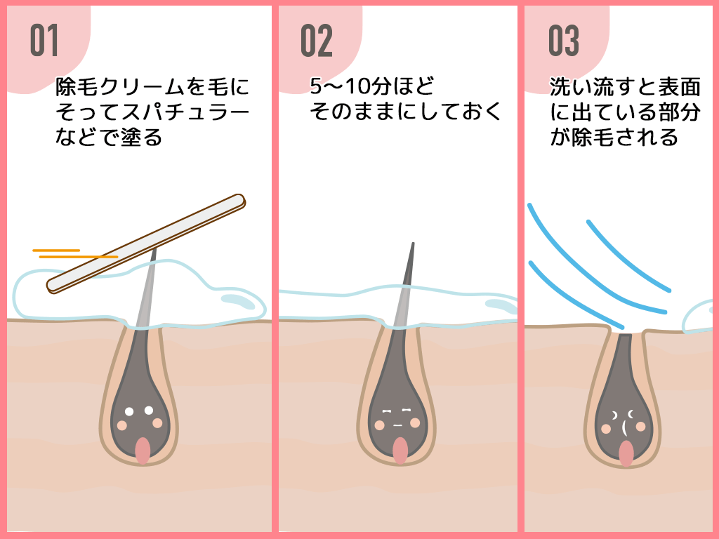 除毛クリームの効果は本当？永久脱毛との違いや持続期間を徹底検証