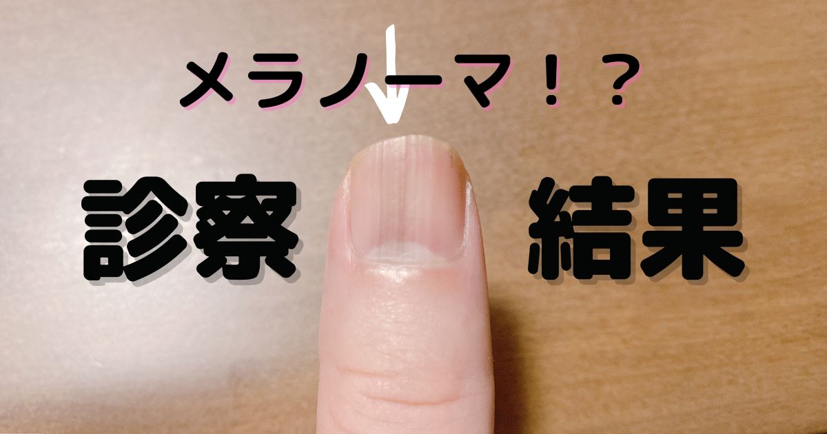 アボカド犬ダメは本当？2026年最新・獣医師データで見る危険性と安全な判断基準