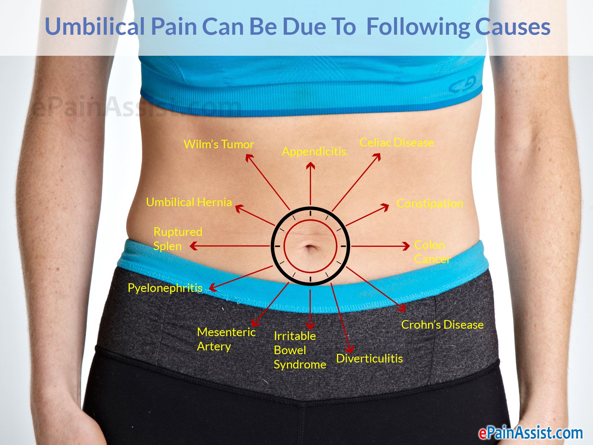 Pain Near the Navel on the Right Side