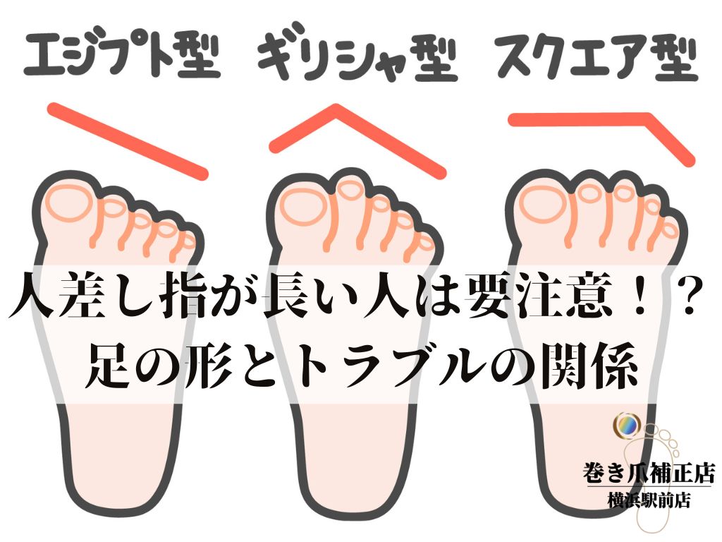 足の人差し指が長い理由と真相！親より出世の言い伝えと正しい靴選び