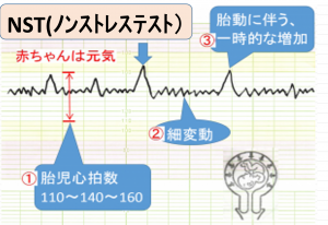 【熱愛】 ノン ストレス と は 2026年最新芸能速報 #873