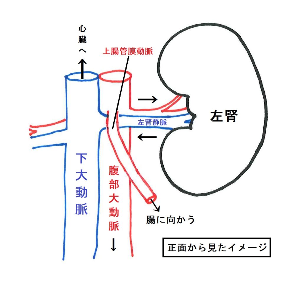 原因不明の血尿と左側腹部痛！ナットクラッカー症候群の真相と治療法