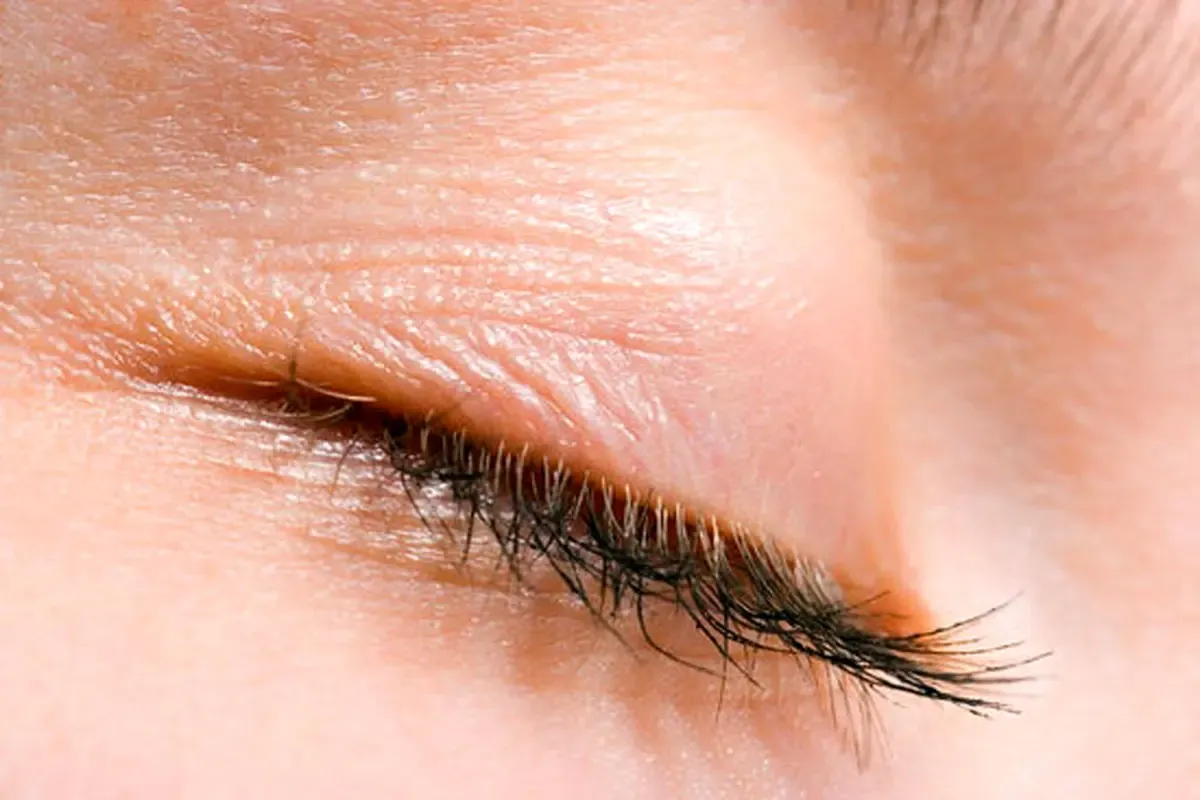 Why Do My Eyelashes Hurt When I Touch Them