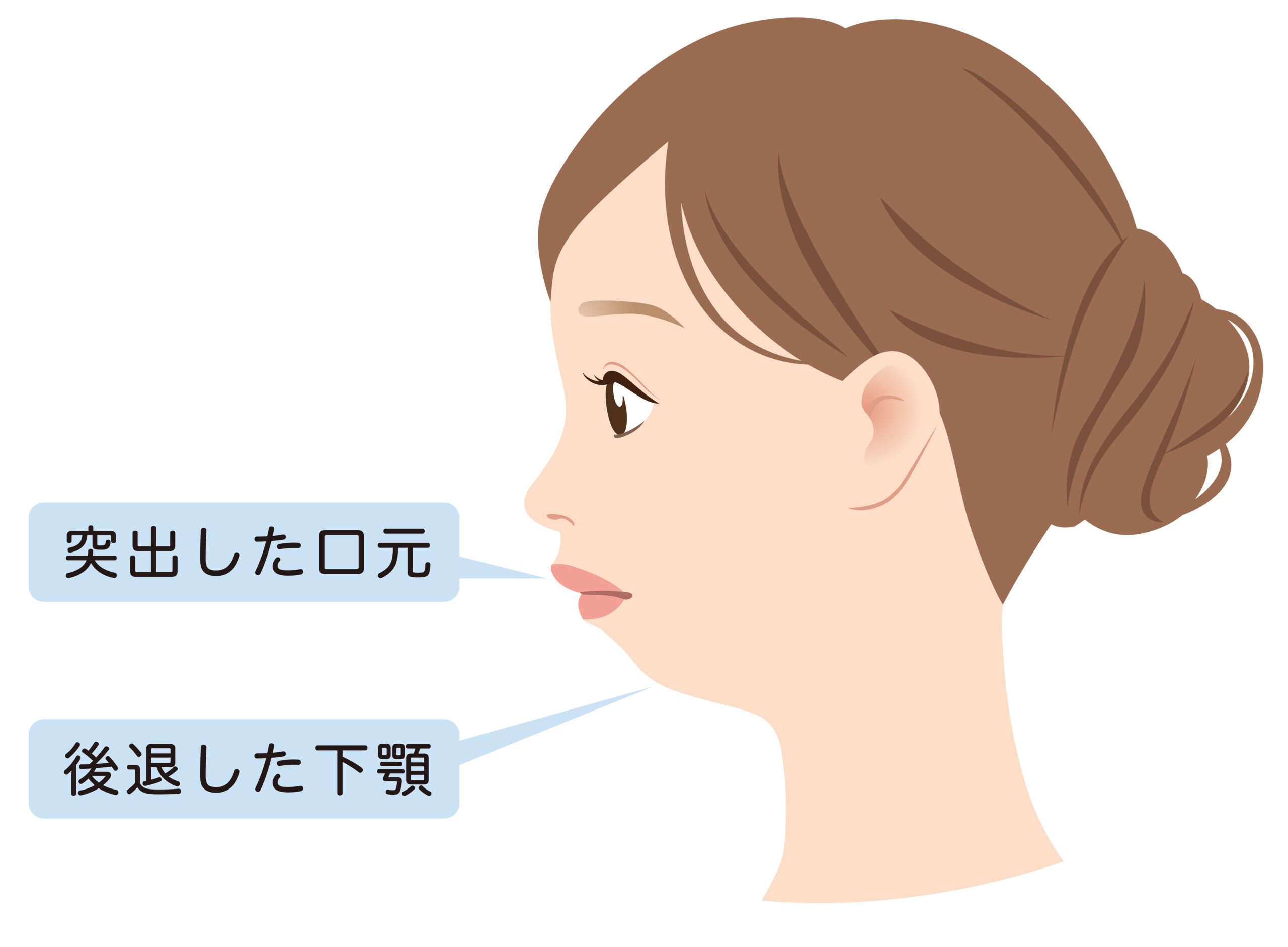 なぜ横顔に自信が持てない？顎がない顔の根本原因と劇的改善法を追跡