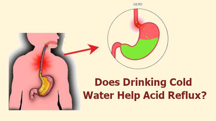 Does Cold Water Cause Heartburn