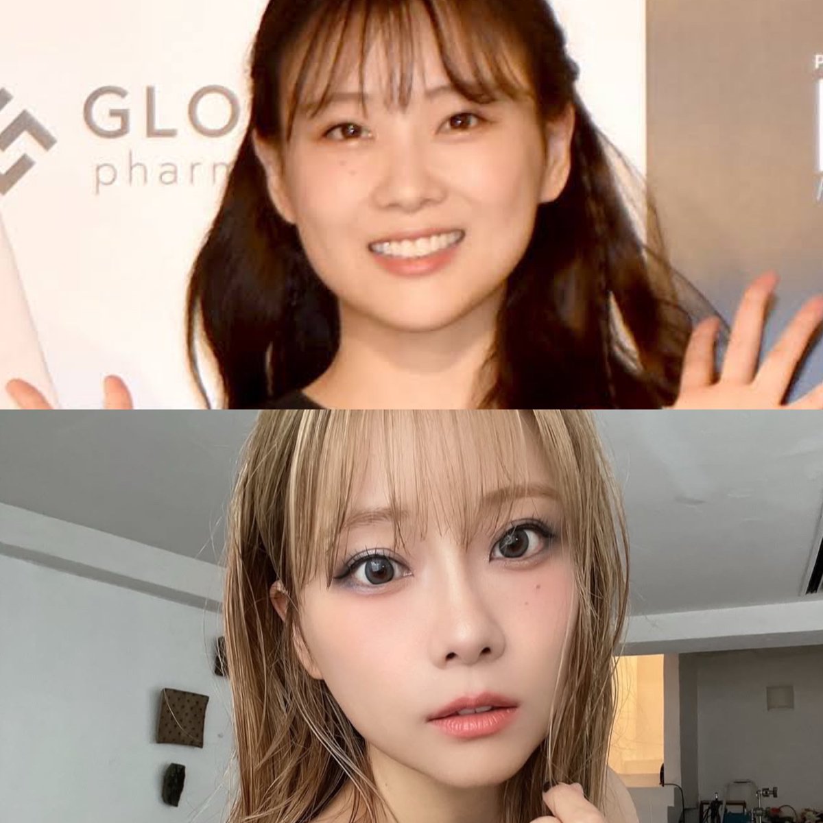 重盛さと美の整形疑惑は本当？昔の顔と現在を徹底比較して見えた真相