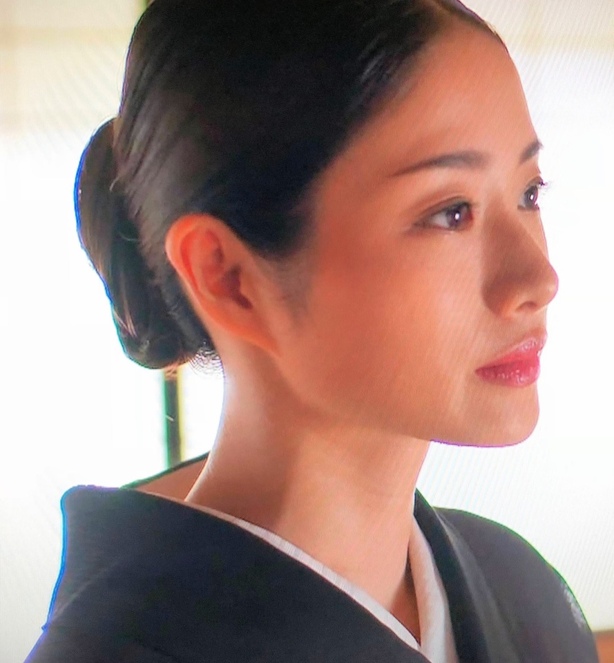 もみあげ脱毛を明かした芸能人は誰？失敗しない小顔整顔術と愛用院