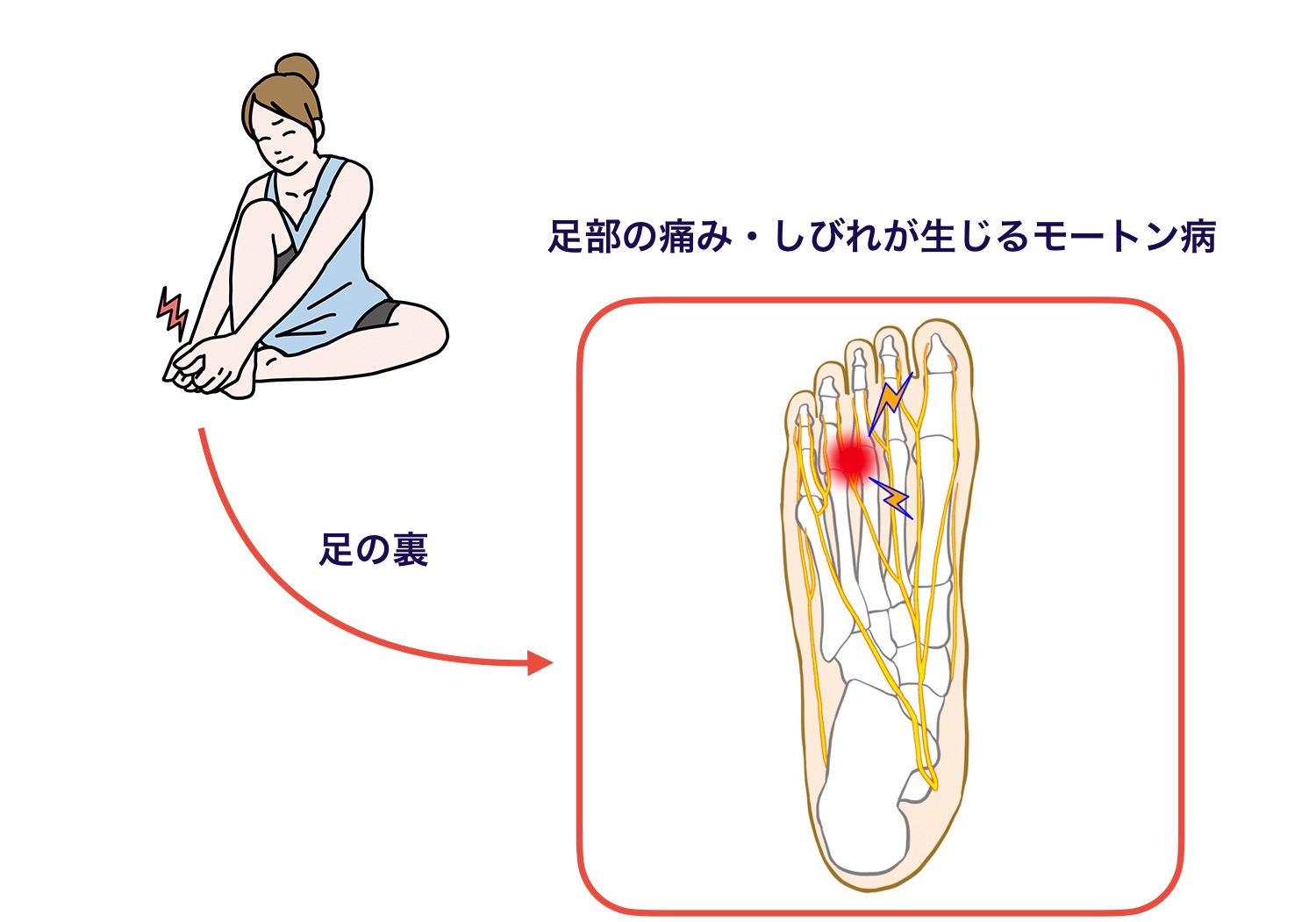 足の指のしびれを放置するな！重大疾患のサインと受診科の見分け方