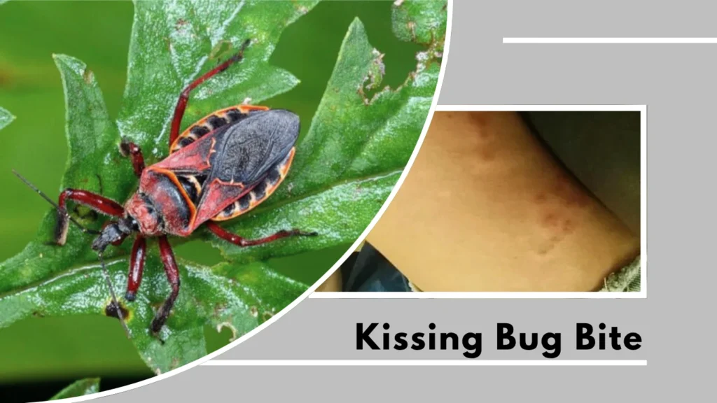 Can You Feel a Kissing Bug Bite
