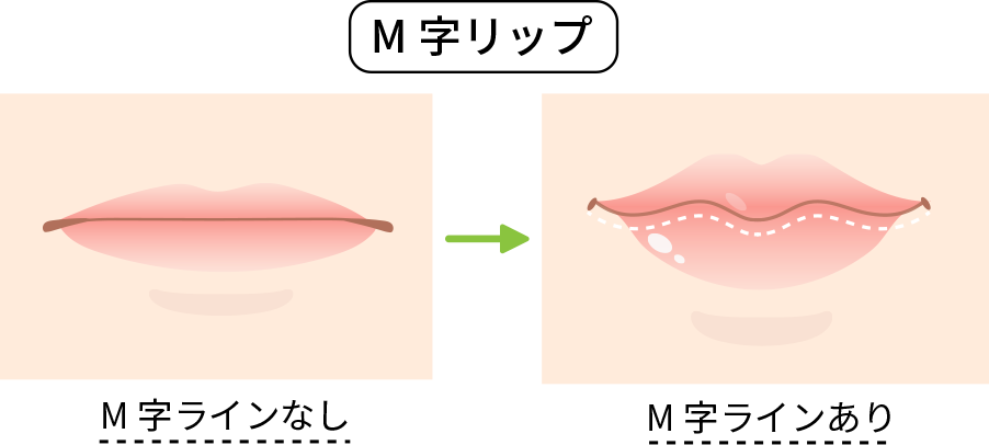 M字はげにツーブロックは逆効果？失敗の真相と2026年似合う髪型