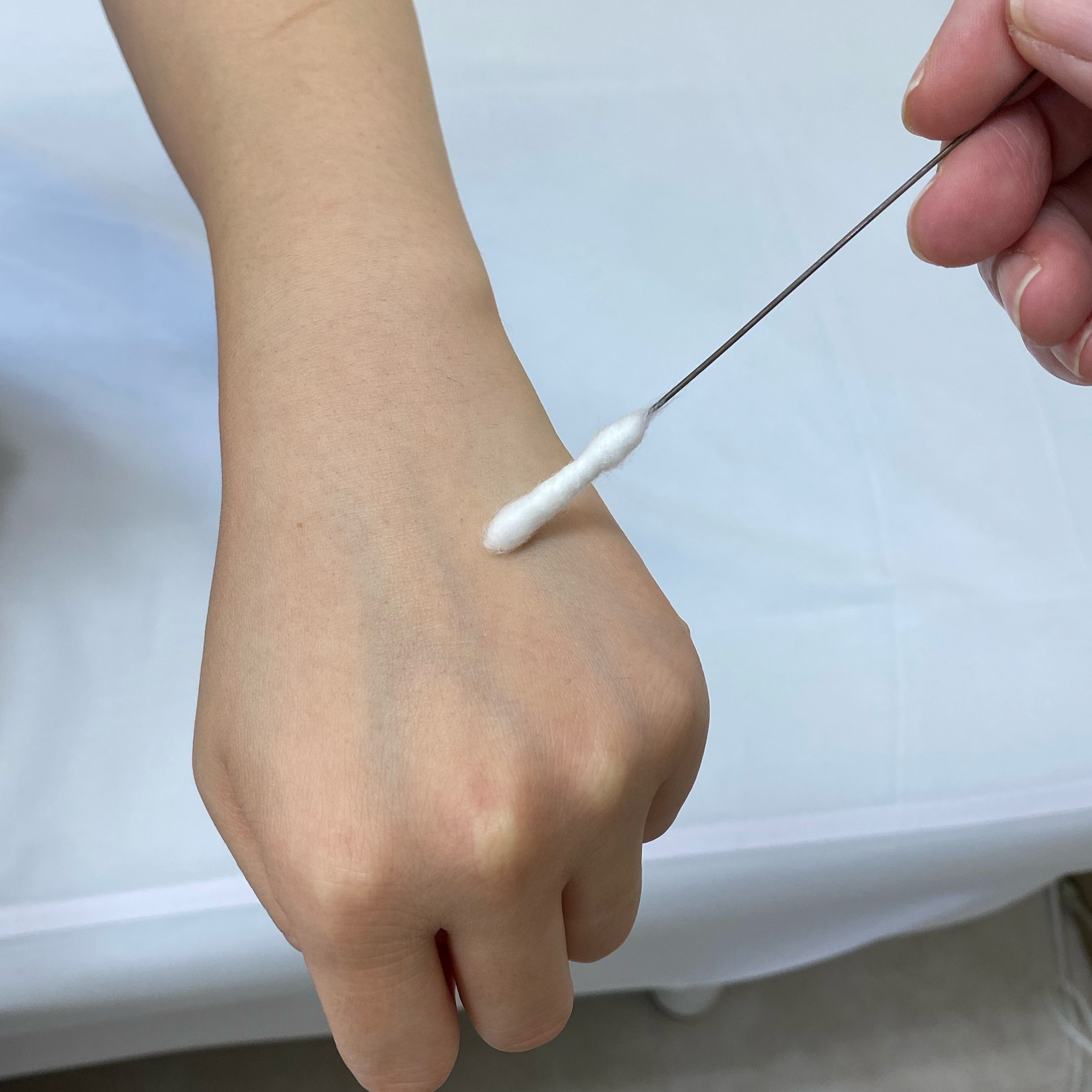 イボの液体窒素はなぜ痛い？通院回数と黒くなって取れない真相【2026】
