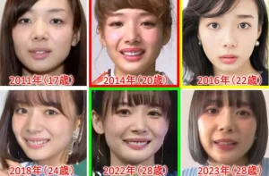 【噂】 岡田 紗 佳 整形 人気理由と評判まとめ #794
