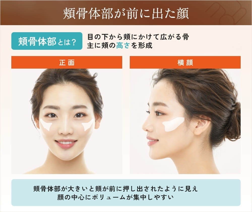 頬骨が横に出てる原因とは？骨格の真相と自力改善＆輪郭対策2026