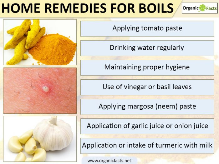 Home Remedies for Underarm Boils