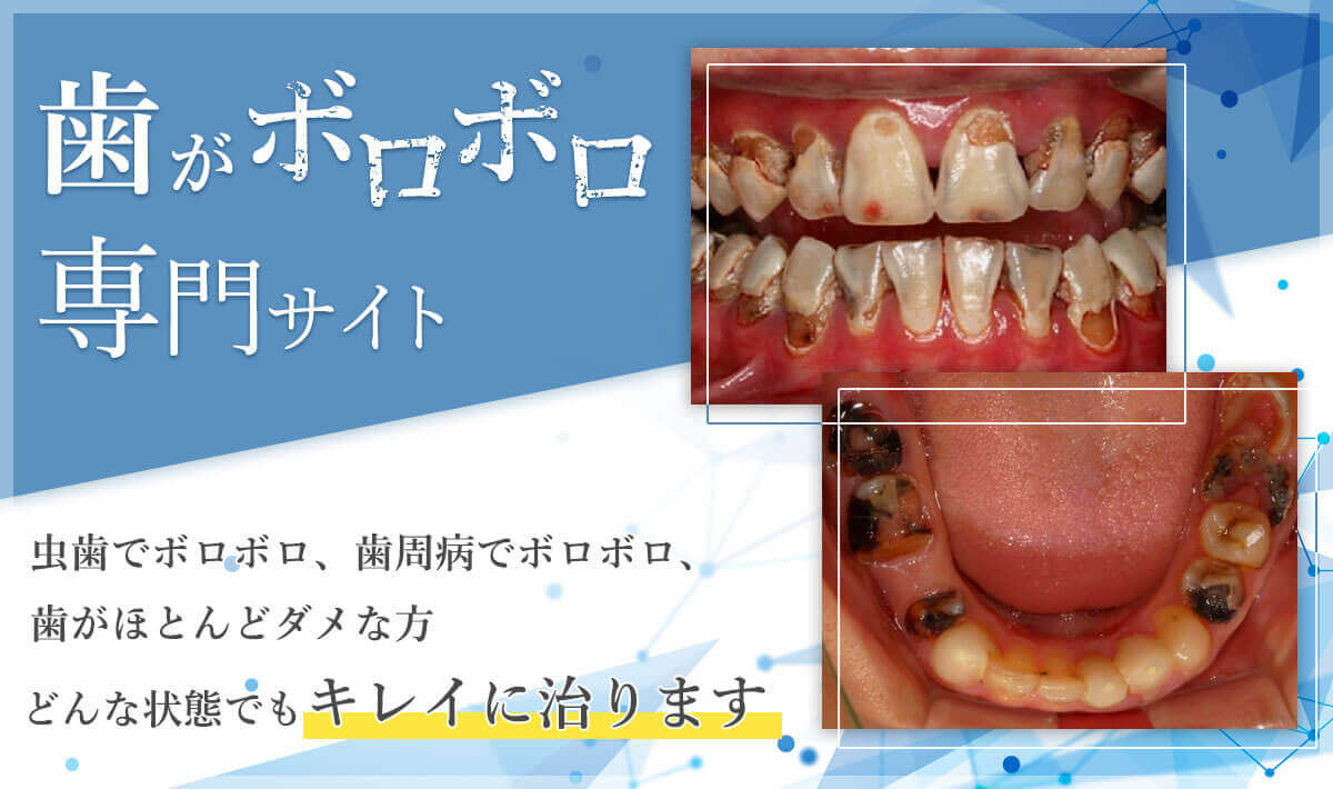 歯がボロボロで歯医者が恥ずかしい？歯科医の本音と怒られない選び方