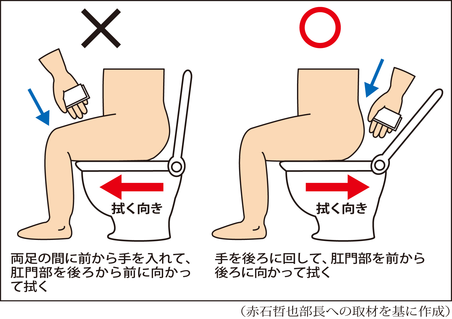 お尻の悲鳴に気づいてる？肛門科医が明かす最新の正しい拭き方