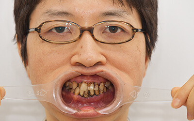 【衝撃】 歯 が ボロボロ 芸能人 最新情報まとめ 2026 #717