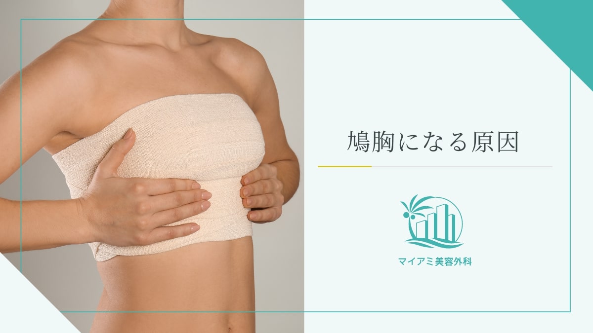 女性の鳩胸の見分け方と特徴｜ブラの浮きや着太りを防ぐ骨格別解決策