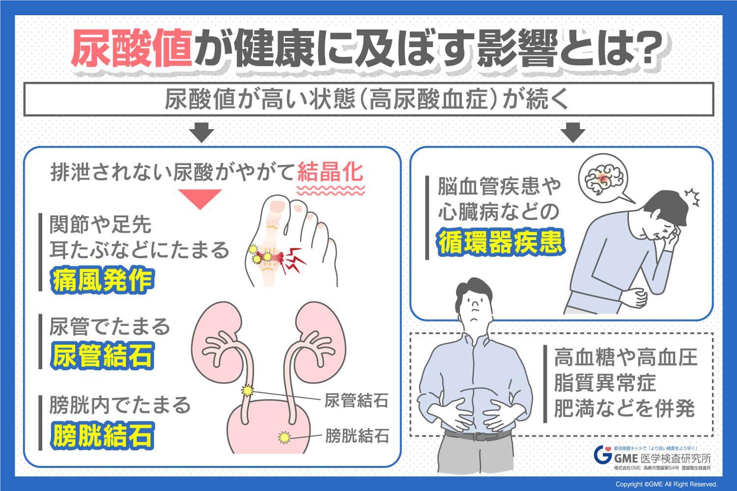 尿酸値とは？基準値7.0超のリスクと数値を下げる最新対策