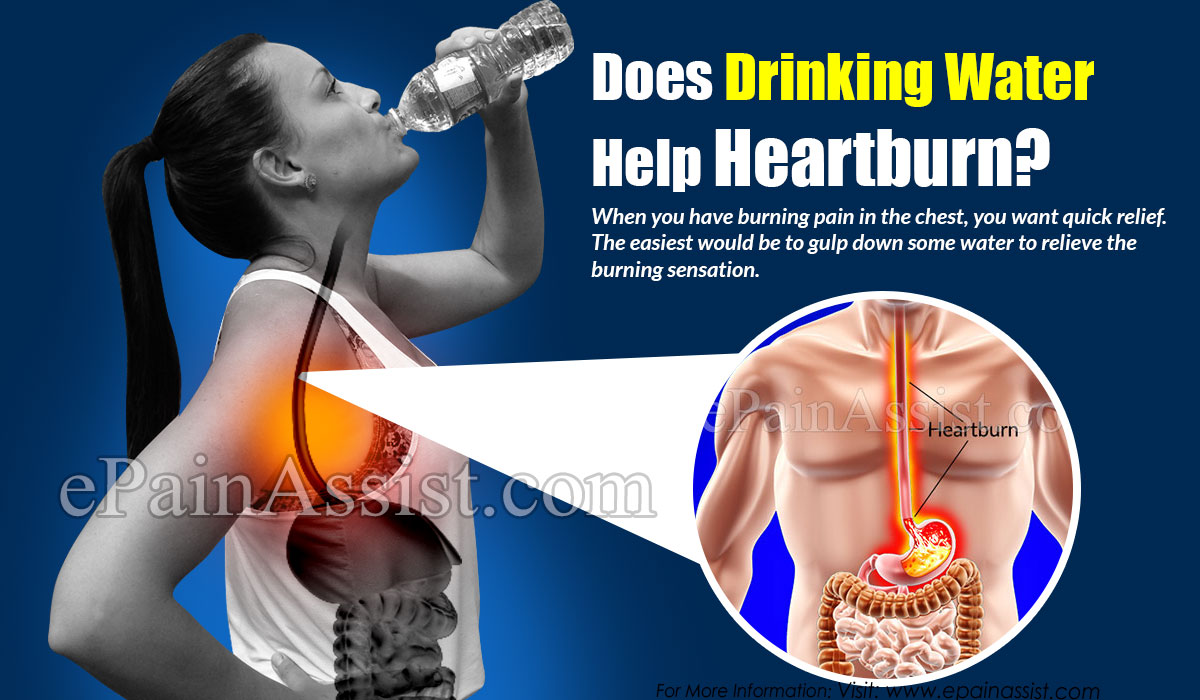 Does Drinking Too Much Water Cause Heartburn
