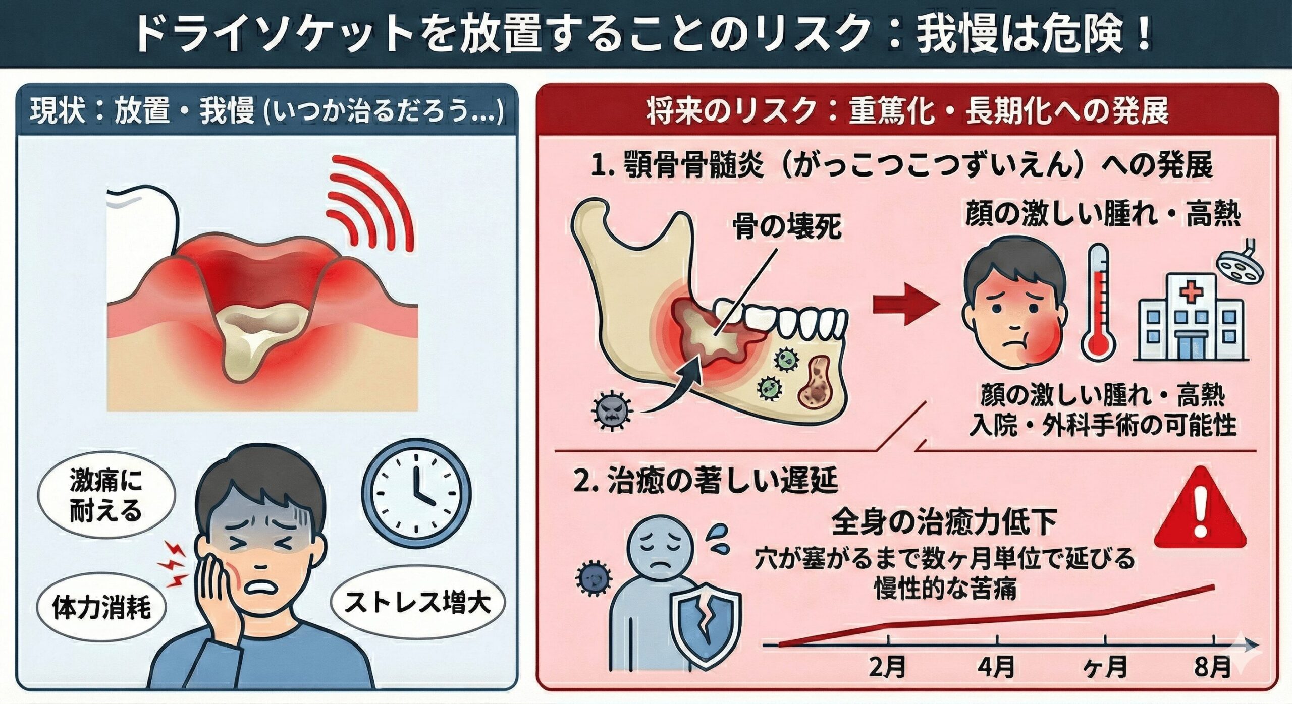 ドライソケットの治し方｜抜歯後の激痛を最短で鎮める治療と対処法