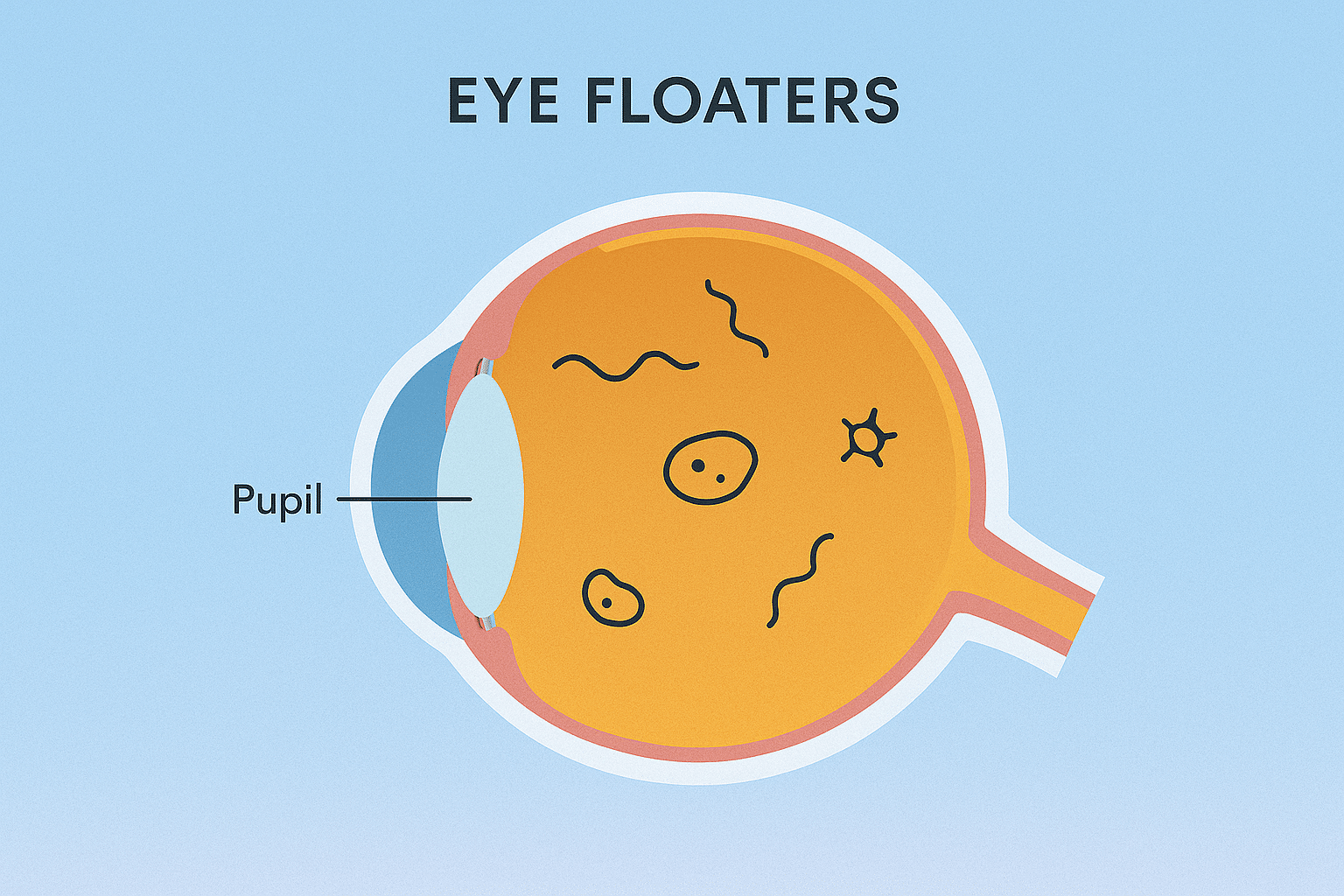 Its a Floater Meaning