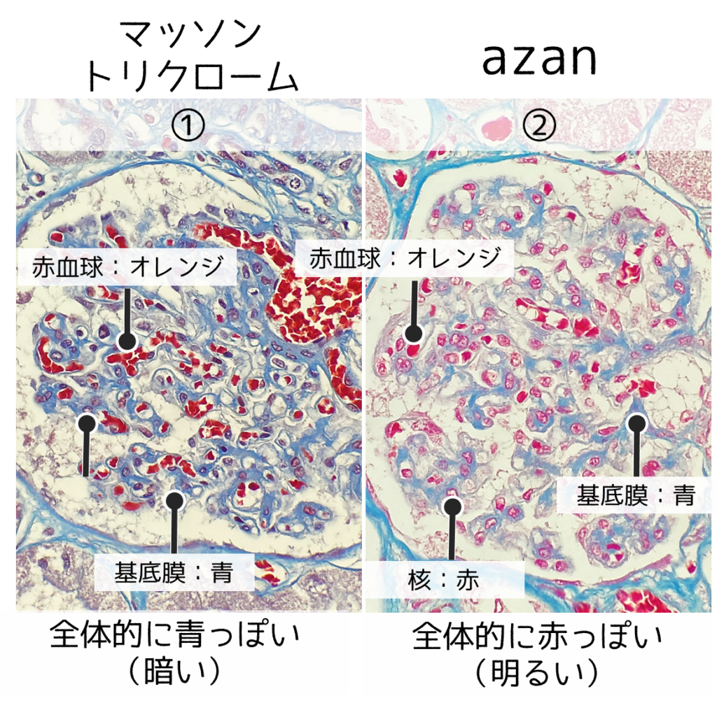 マッソントリクローム染色の原理と判別法｜膠原線維の染め分けと失敗回避術