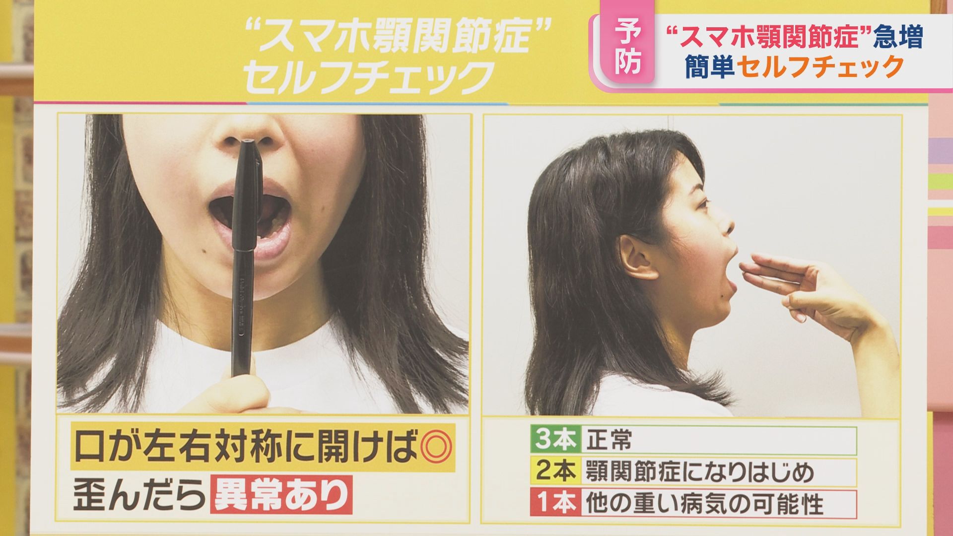 「一生モノの顎」を取り戻す。2026年、スマホ首とストレスが引き起こす顎関節症を自宅で1分リセットする新常識