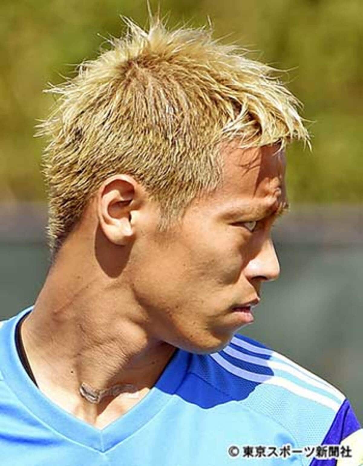 本田圭佑の目はなぜ変わった？バセドウ病と手術痕の真相【2026最新】