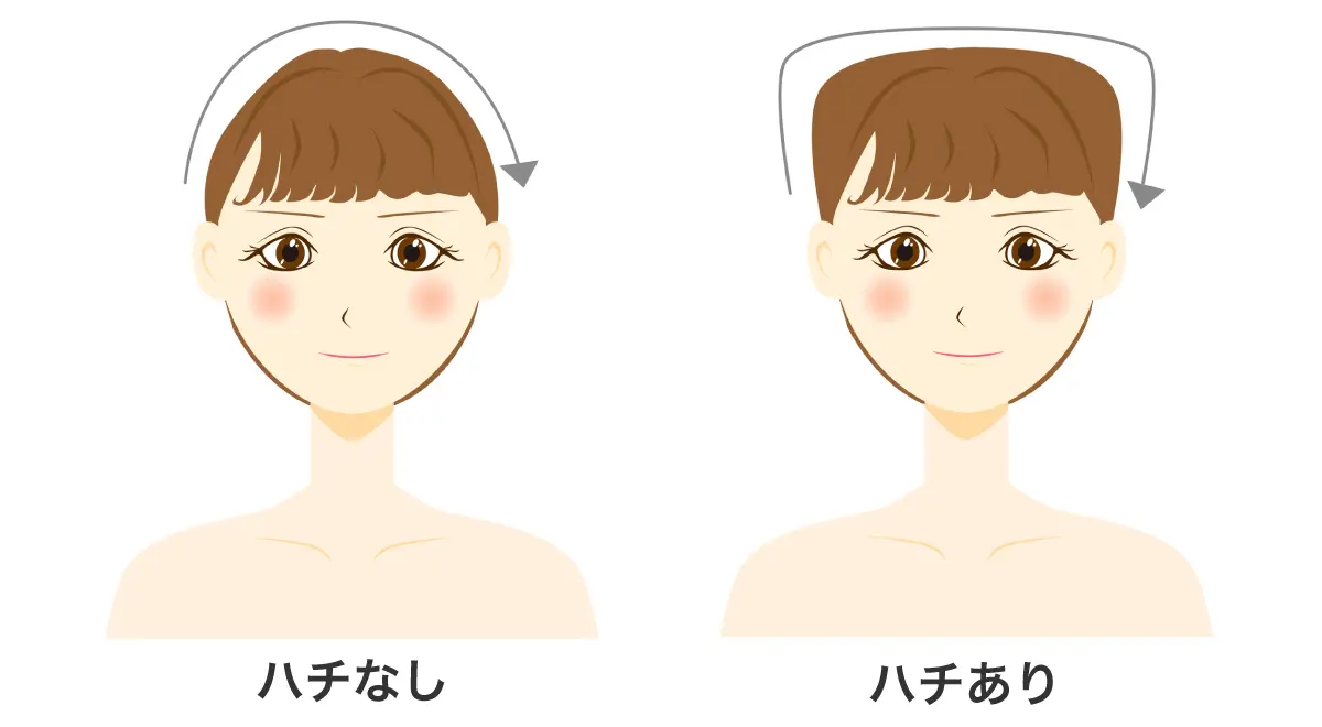頭のハチ張りは治せる？骨格以外の原因と似合う髪型・最新改善術