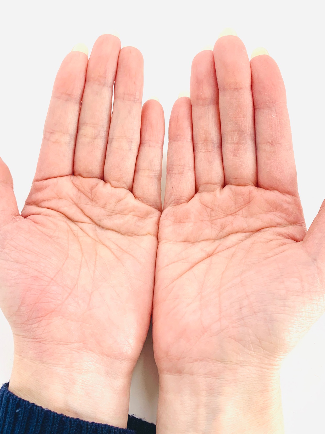 両手ますかけ線の真相｜千人に一人の天下取り相と変人噂の決定打
