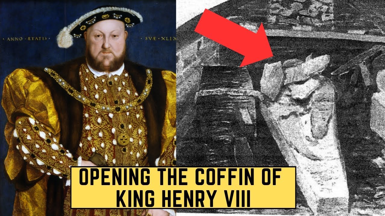 How Did King Henry Viii Die