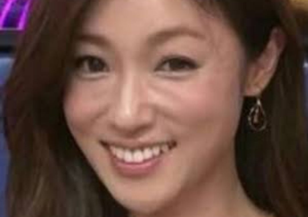 笑うと目立つゴルゴ線の原因とは？20代の理由と正しい消し方・対策