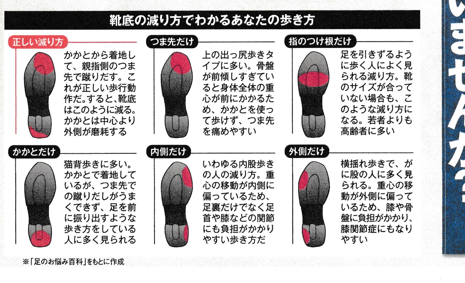 靴の外側が減る原因とは？O脚や骨盤の歪みを見抜くセルフ診断と改善策