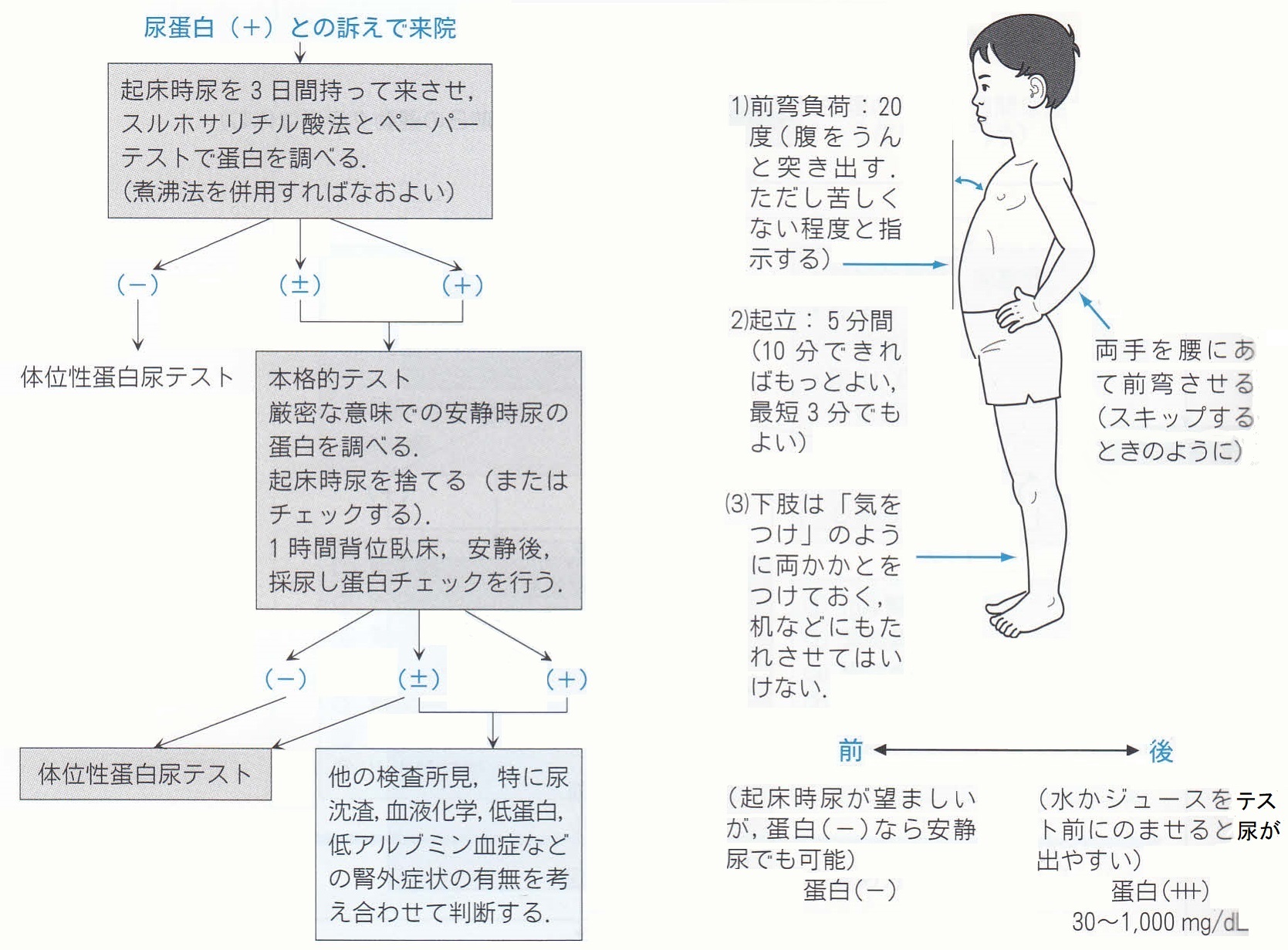 起立性タンパク尿の真相｜学校検尿の陽性判定と放置リスクを徹底検証
