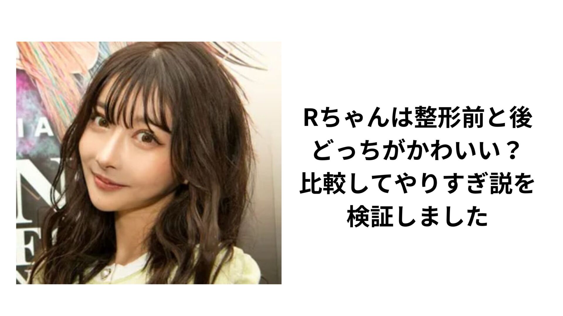 【2026年最新視点】Rちゃんが整形前後の自分と向き合い続けた10年——総額3000万円を超えた美の探求と「自己肯定感」の真相