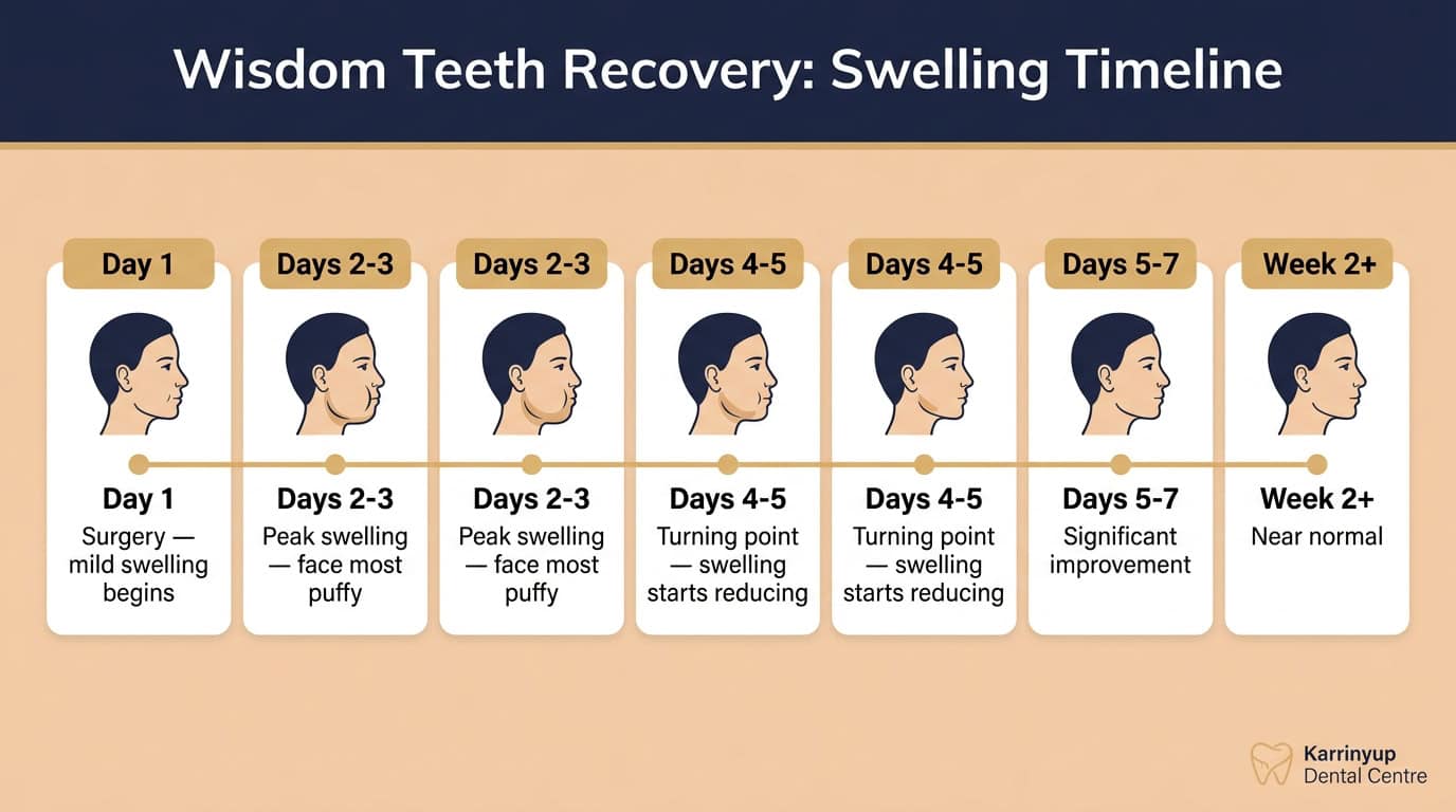 How Long Does Wisdom Teeth Pain Last