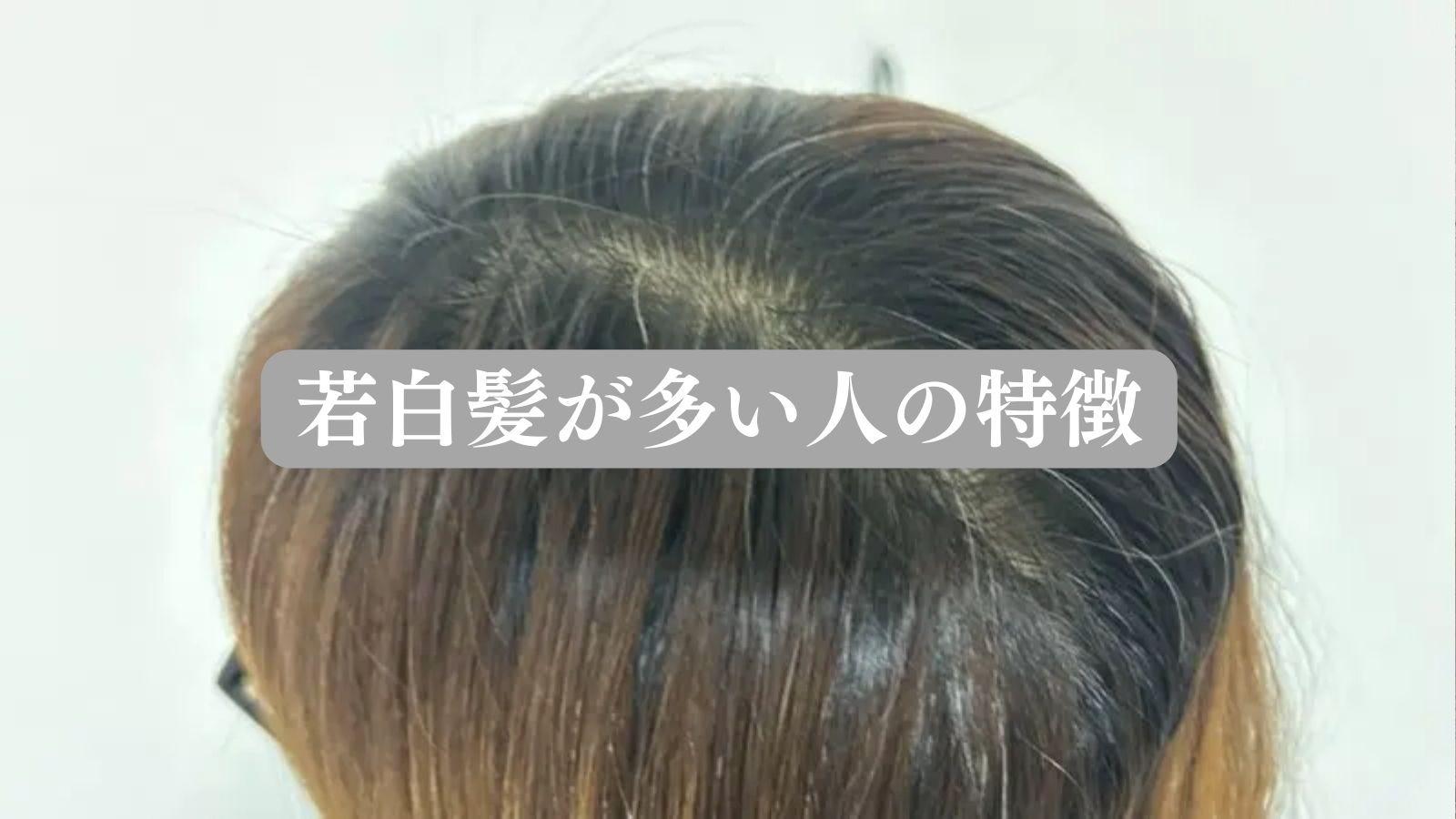 白髪が多い人の特徴とは？2026年最新研究で迫る急増のサイン