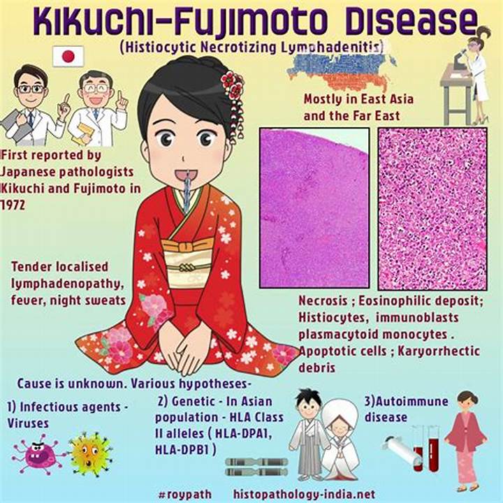 菊池 病 と は？症状・原因不明の経過、診断の決め手を解説